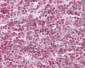 CSTB / Cystatin B / Stefin B Antibody